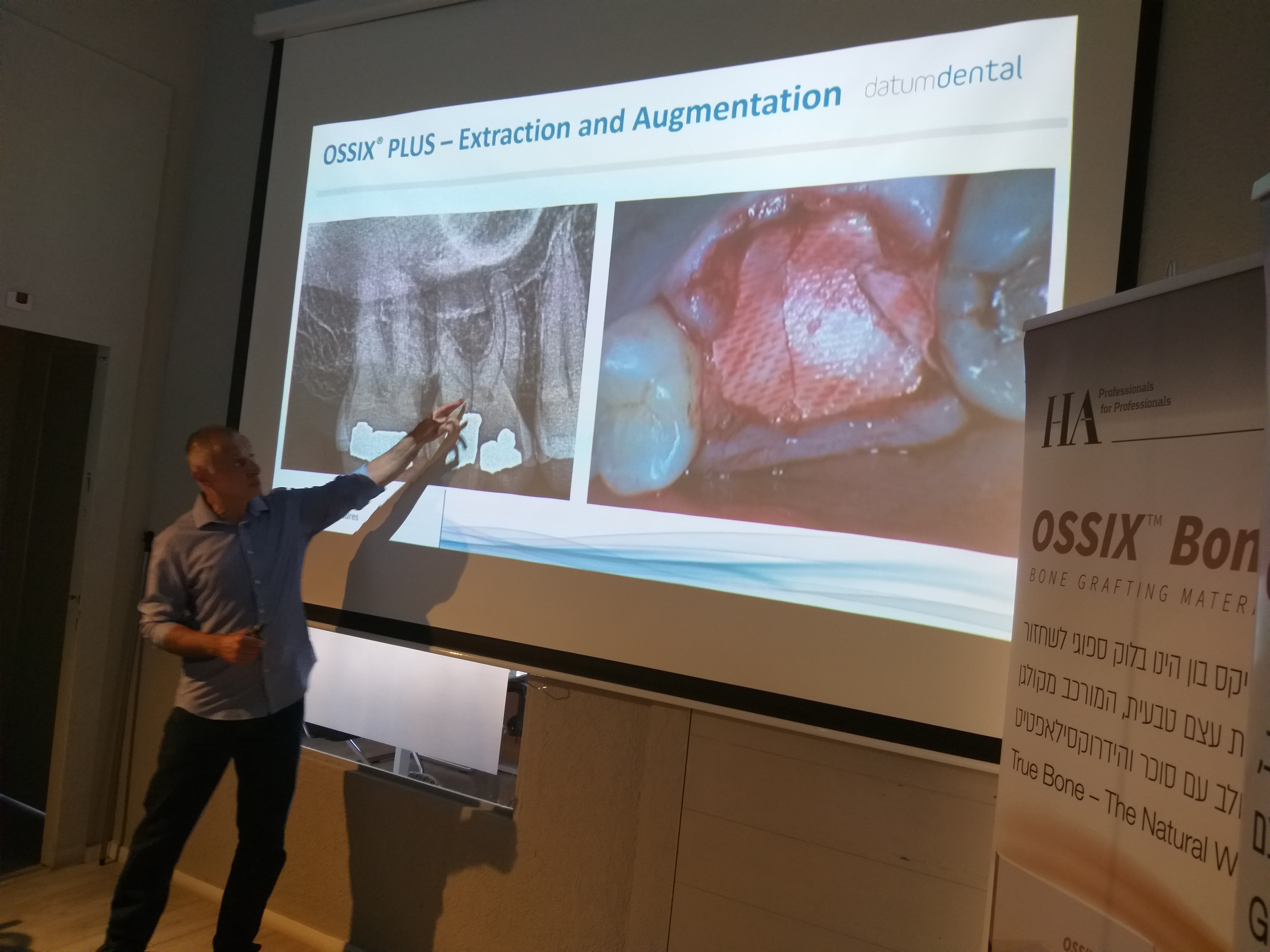 קורס אוגמנטציה לחברי איגוד שיקום הפה עם ד"ר יובל צוברי 10.07.19