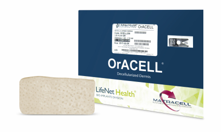 ORACELL